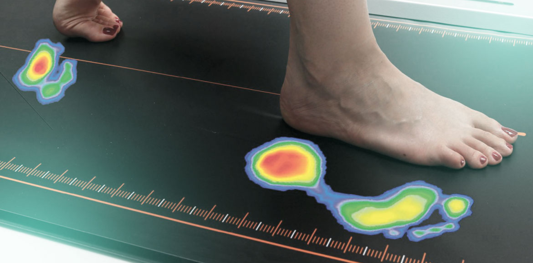 Paromed Blog The foot analysis an experience
